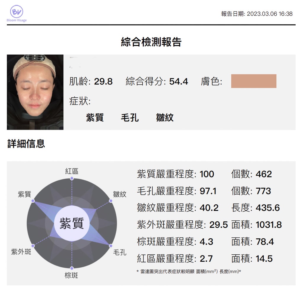 桃園中壢美容|梵夏美學中心|韓式深層煥顏,臉部肌膚檢測結果…太驚人啦!深層清潔去角質讓肌膚煥然一新~ - 第6張圖