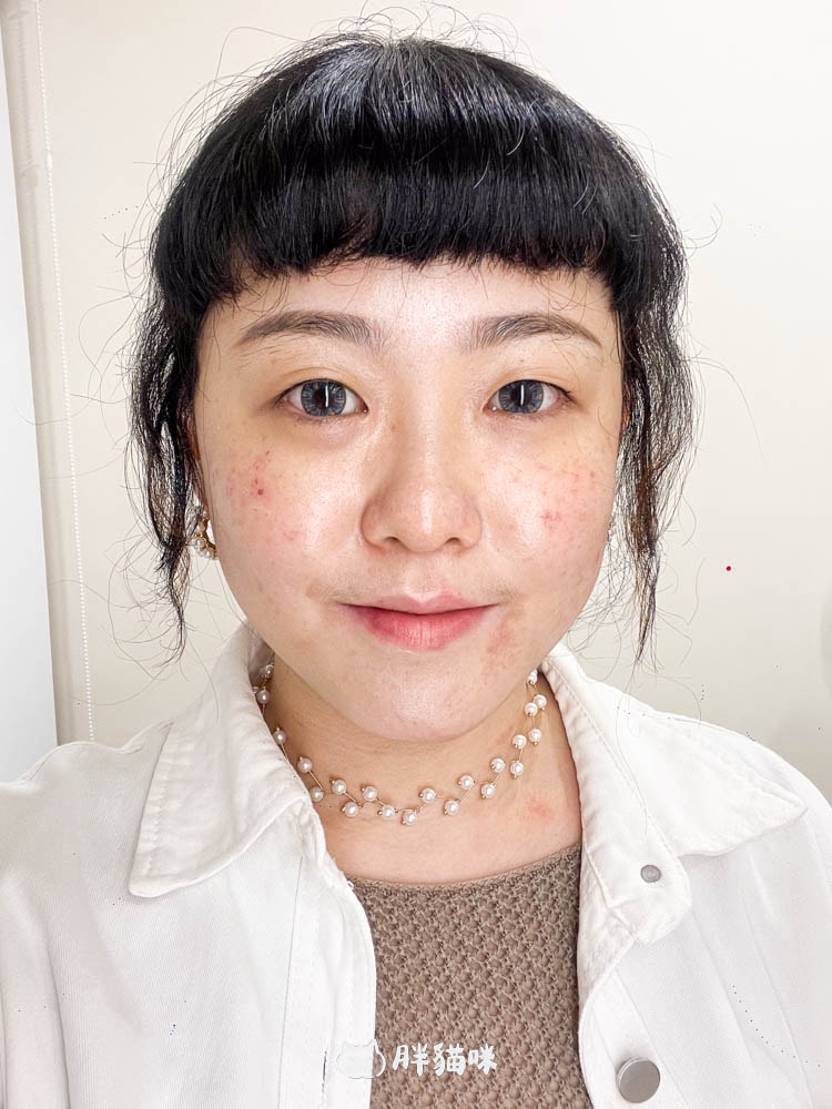 【台北皮秒雷射推薦】我在巧之妍美學診所打雷射啦!毛孔、黑斑OUT,這次真的有被療癒到~ - 第12張圖