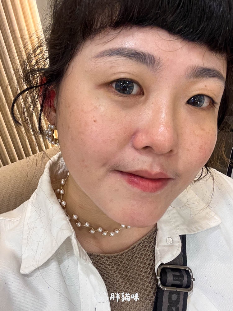 【台北皮秒雷射推薦】我在巧之妍美學診所打雷射啦!毛孔、黑斑OUT,這次真的有被療癒到~ - 第5張圖