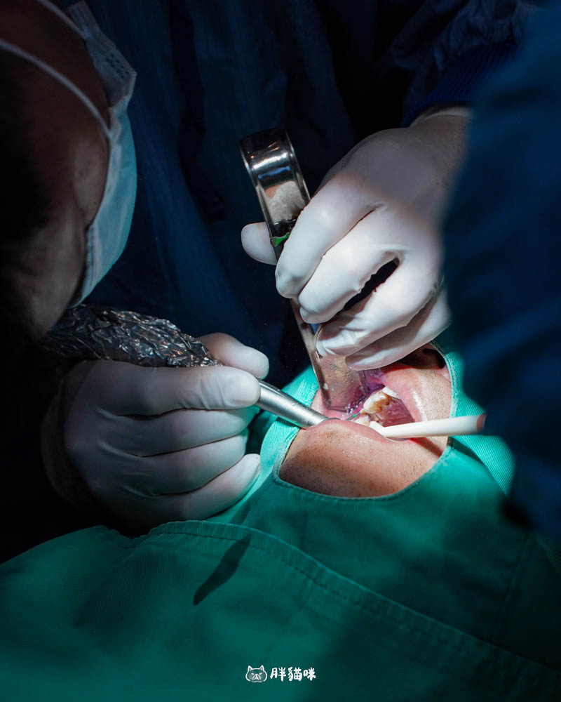 【林口植牙推薦】植牙需要花多久？超詳細人工植牙心得與5步驟流程，術後心得老實說！