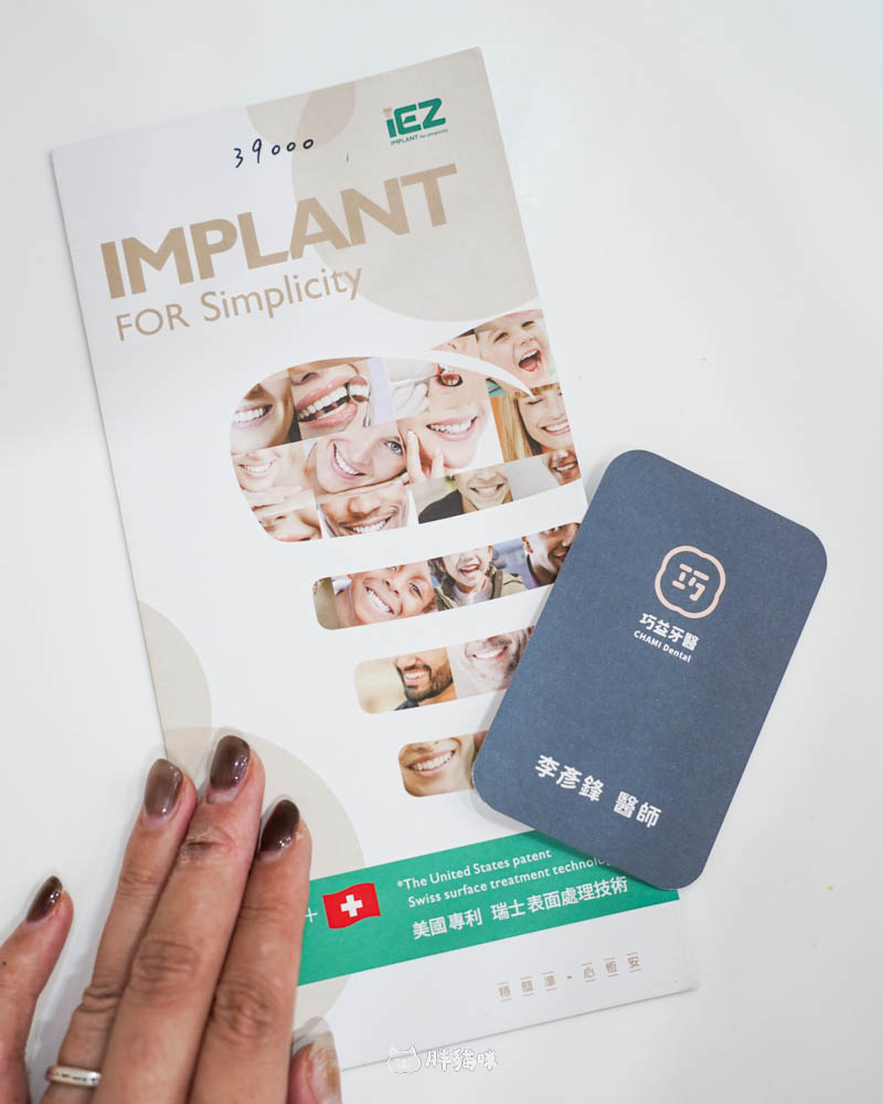 【林口植牙推薦】植牙需要花多久？超詳細人工植牙心得與5步驟流程，術後心得老實說！