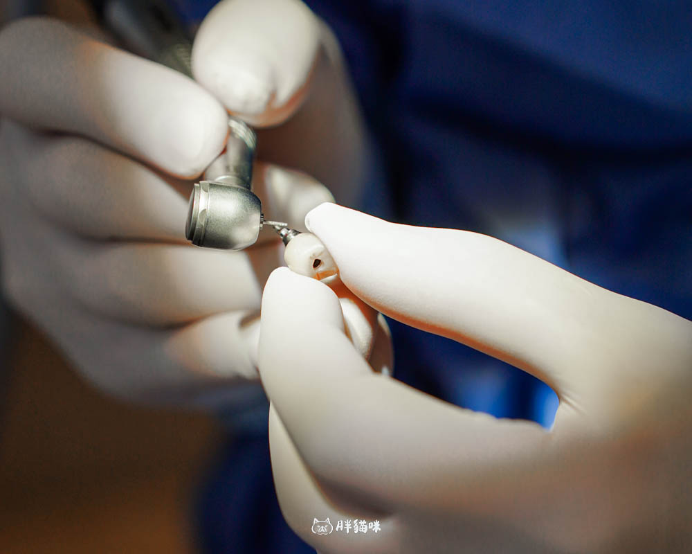 【林口植牙推薦】植牙需要花多久？超詳細人工植牙心得與5步驟流程，術後心得老實說！