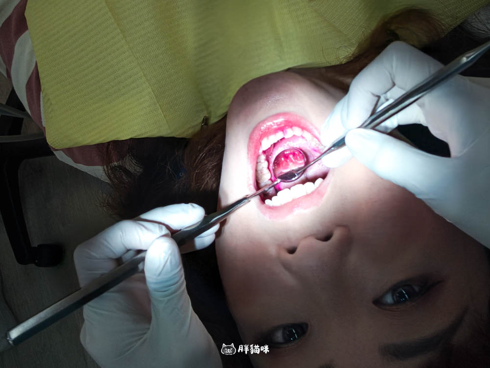 【新店牙醫推薦|大坪林牙醫 玉美學牙醫診所】洗牙不再懼怕!檢查流程感受一次分享 - 第14張圖