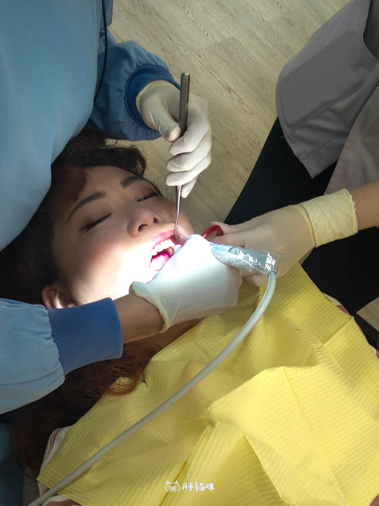 【新店牙醫推薦|大坪林牙醫 玉美學牙醫診所】洗牙不再懼怕!檢查流程感受一次分享 - 第13張圖