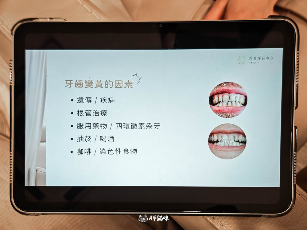 台北牙齒亮白保養推薦:淬齒淨白中心40分鐘亮白體驗,深層淨白親測真實心得! - 第7張圖 台北牙齒亮白保養推薦:淬齒淨白中心40分鐘亮白體驗,深層淨白親測真實心得!