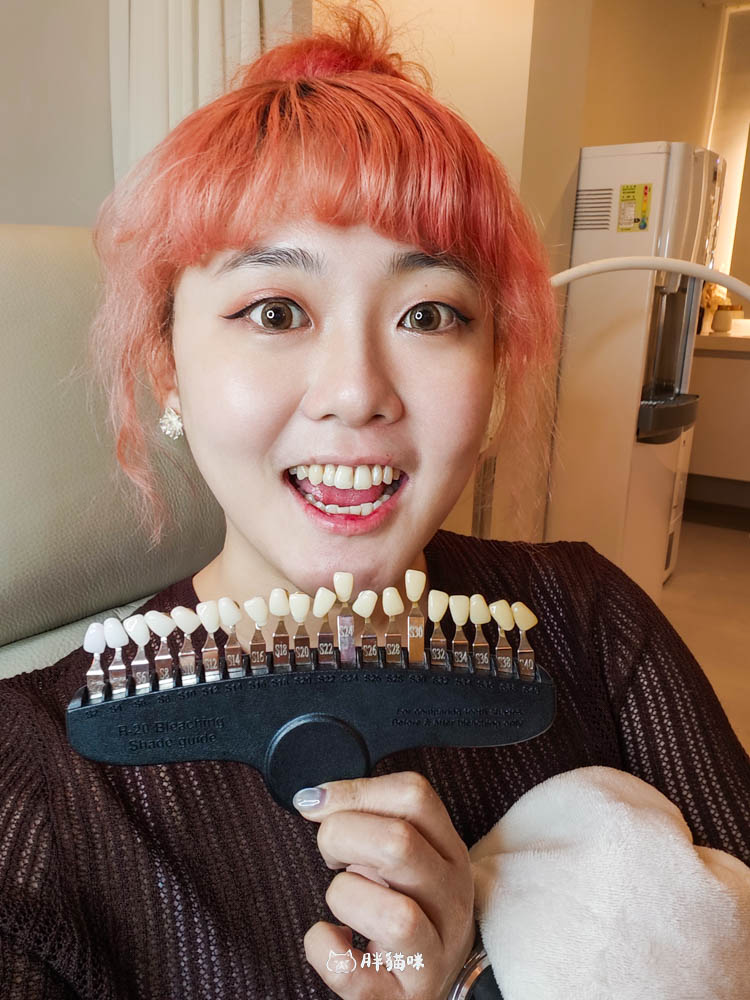 台北牙齒亮白保養推薦:淬齒淨白中心40分鐘亮白體驗,深層淨白親測真實心得! - 第22張圖 台北牙齒亮白保養推薦:淬齒淨白中心40分鐘亮白體驗,深層淨白親測真實心得!